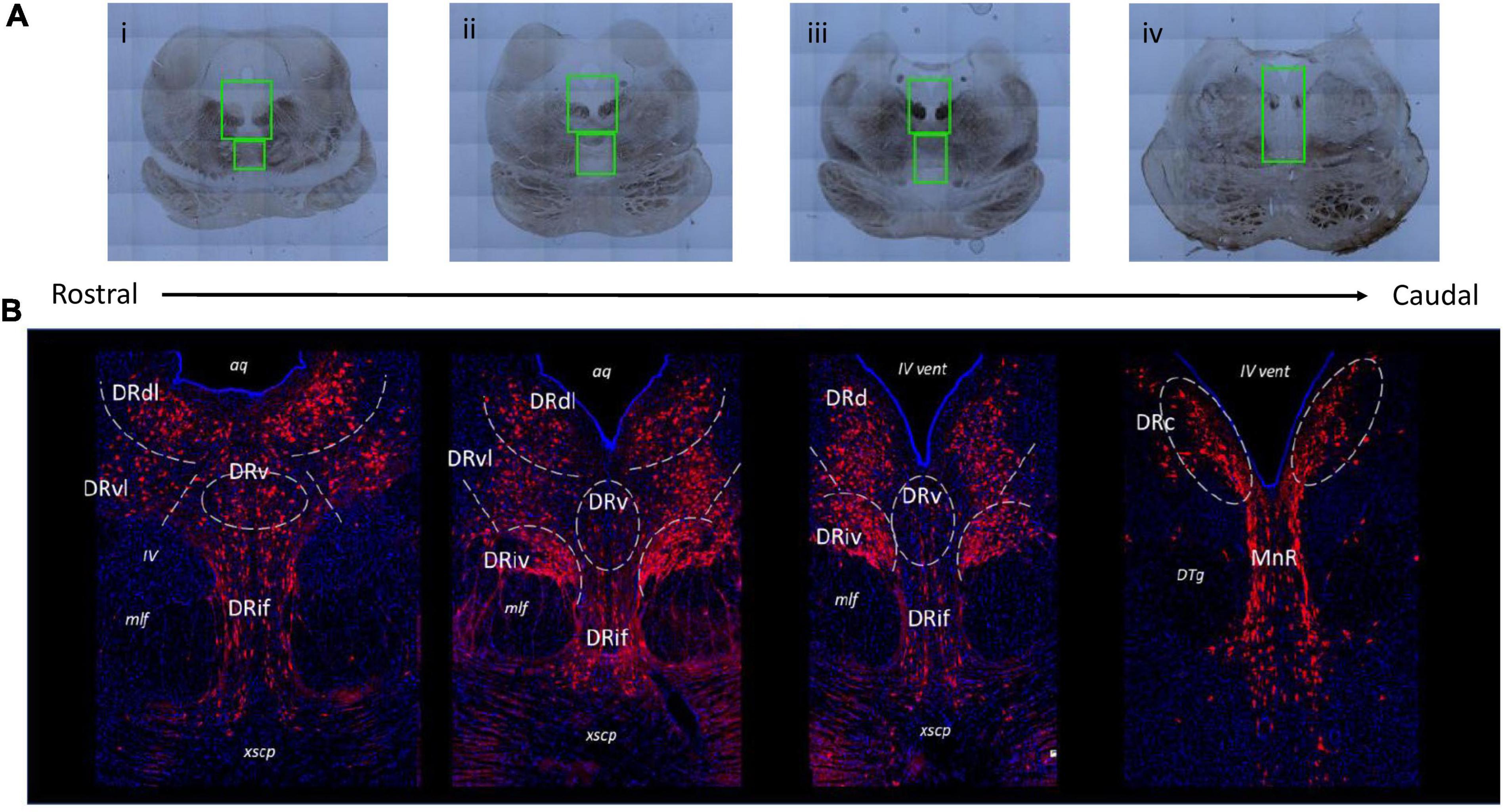 Perinatal Western-style diet alters serotonergic neurons in the macaque raphe nuclei